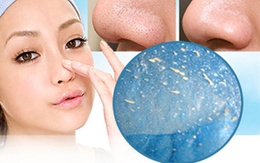 Tẩy sạch mụn đầu đen