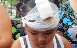 Bé gái 4 tuổi bị nhánh cây rơi trúng ở trung tâm Sài Gòn