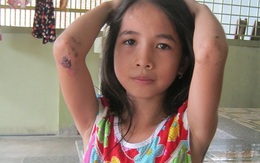 Vật lộn 2 tiếng dưới giếng, bé gái thoát chết