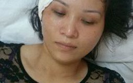 Hải Phòng: Súng công an xã cướp cò làm bạn gái bị thương