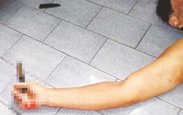 Bảo vệ đâm phó tổng giám đốc