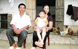 Gia đình bệnh nhân "ma cà rồng" đầu tiên ở Việt Nam: Mẹ cha gồng gánh nợ nần
