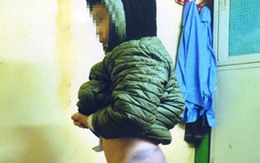 Hà Nội: Cháu bé 8 tuổi bị bạo hành