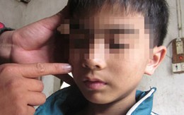 Vụ cha đẻ đánh đập, bắt con ăn phân:  Mẹ kế thuật chuyện bạo hành