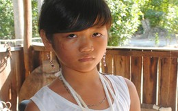 Bị nghi trộm tiền, bé gái bị cậu đánh gãy tay