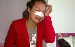Vợ cán bộ xã lột quần áo chà quả ngứa tình địch 
