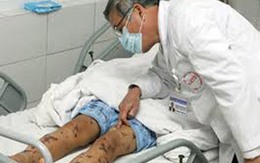 Bệnh viêm não mô cầu: Nguy hiểm, dễ lây lan