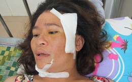 Chồng cũ hành hung vợ khâu 73 mũi