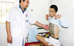Nghiện “đập đá”: Nhập viện tâm thần “tránh nắng”