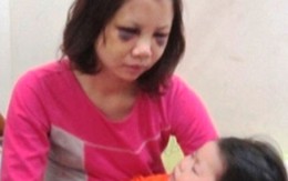 Bất lực nhìn con gái bị đánh vì sợ rể trả thù