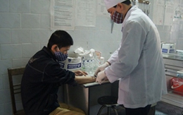 Nguy cơ mắc lao ở người nhiễm HIV