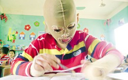 Ước mơ của Minh