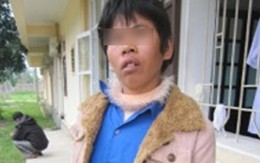 Một phụ nữ thần kinh tố cáo bị hiếp dâm