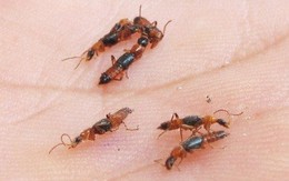 Dấu hiệu nguy hiểm khi bị kiến đốt