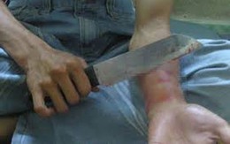 Dấu hiệu nhận biết người bị "ngáo đá"