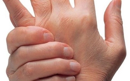 Bẻ khớp nhiều lần sẽ làm sụn bào mòn, dễ thoái hóa
