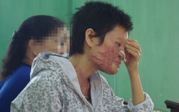 Cuộc đời khốn cùng của người đàn bà bị chồng tạt axít mù mắt