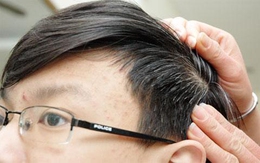Ăn mặn dễ dẫn đến bạc tóc
