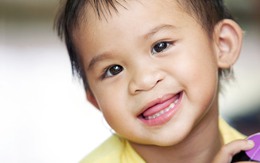 Phẫu thuật nụ cười cho trẻ em dị tật khe hở môi, hàm ếch bẩm sinh