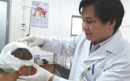 Nối thành công mảnh da đầu cho người bị máy cuốn
