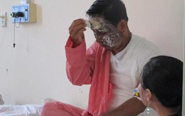 Ghen tuông, vợ nấu nước sôi "luộc" chồng