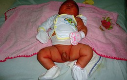 Bé sơ sinh nặng gần 6 kg ở Bình Định