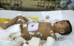 Bé trai cụt chân, mất cả cha lẫn mẹ trong tai nạn