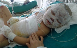 Nổ bình ga, 1 người chết, 6 người bỏng nặng