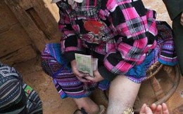 Bé gái 3 năm sống với cái chân lúc nhúc giòi