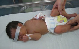 Sức sống mãnh liệt của đứa con bị mẹ bịt miệng