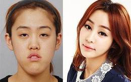 Cuộc "lột xác" ngoạn mục của các cô gái xấu xí