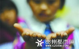 Hai bé gái bị bỏ đói đến chết