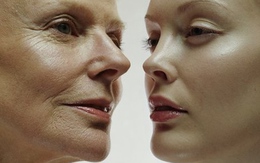 Muốn giảm nếp nhăn, phải nhớ 9 điều