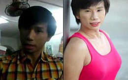Cận cảnh chàng trai Singapore có ngực như phụ nữ