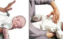Xử trí khi trẻ hóc dị vật ngày Tết