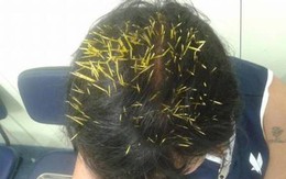 Bị rắn cắn vào của quý khi đi vệ sinh 