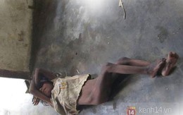 Shock với hình ảnh cô bé “người rừng” vừa được phát hiện