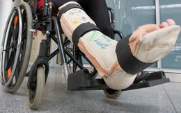 Kỳ lạ những người muốn cắt bỏ chân, tay