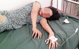 Một phụ nữ bị tra tấn "như thời trung cổ" vì bị nghi ăn cắp