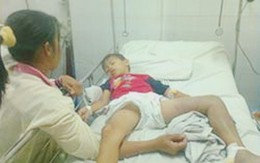 Bé trai nguy kịch vì trị rắn cắn ở thầy lang