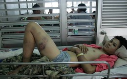 Thanh niên bị gia đình người yêu đánh gãy chân