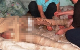 Mua 5 lít xăng về tự thiêu vì giận vợ