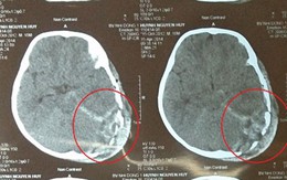 Bị ti vi rớt trúng đầu, bé 2 tuổi chết thương tâm