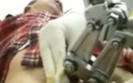 Mắc kẹt vì đeo nhẫn vào "của quý" để cầu hôn bạn gái