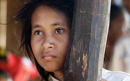 Cuộc sống bí ẩn của cô gái "nửa người nửa thú"