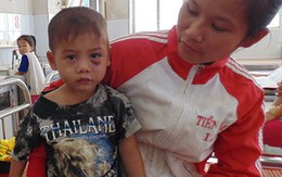 Bé trai ba tuổi bị cha dượng đánh dã man