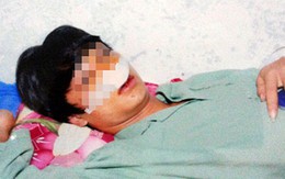 Bị đánh gãy sống mũi vì không đội mũ bảo hiểm?