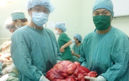 Lấy khối u 11 kg khỏi bụng bệnh nhân