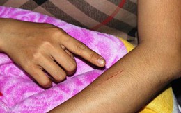 Kinh hoàng thiếu nữ bị rạch lưng dài hơn 10 cm
