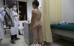 Bé trai bị mẹ kế tra tấn như thời trung cổ